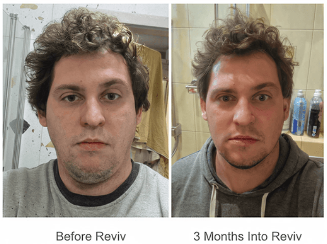 Reviv-Mouth-Guard-Customer-Reviews